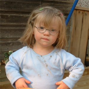 Child with Down's Syndrome